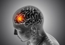 Experts Alert: Brain Tumours May Cause Abrupt Personality Shifts